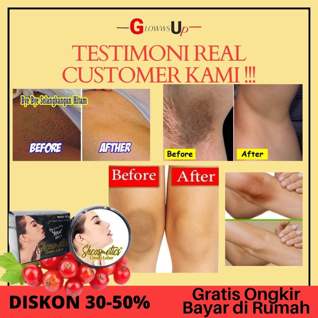 CREAM LEHER SHCOSMETIC ORIGINAL PENCERAH KETIAK PEMUTIH BADAN PERMANEN PERAWATAN TUBUH