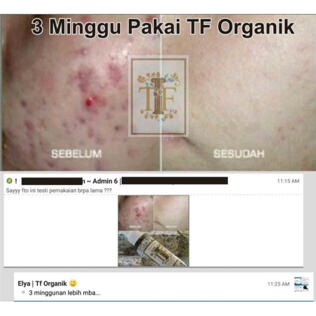 Obat Jerawat Ampuh Cepat Kering | Cleanser Toner - DKMALL TLF Beauty Water 100ml