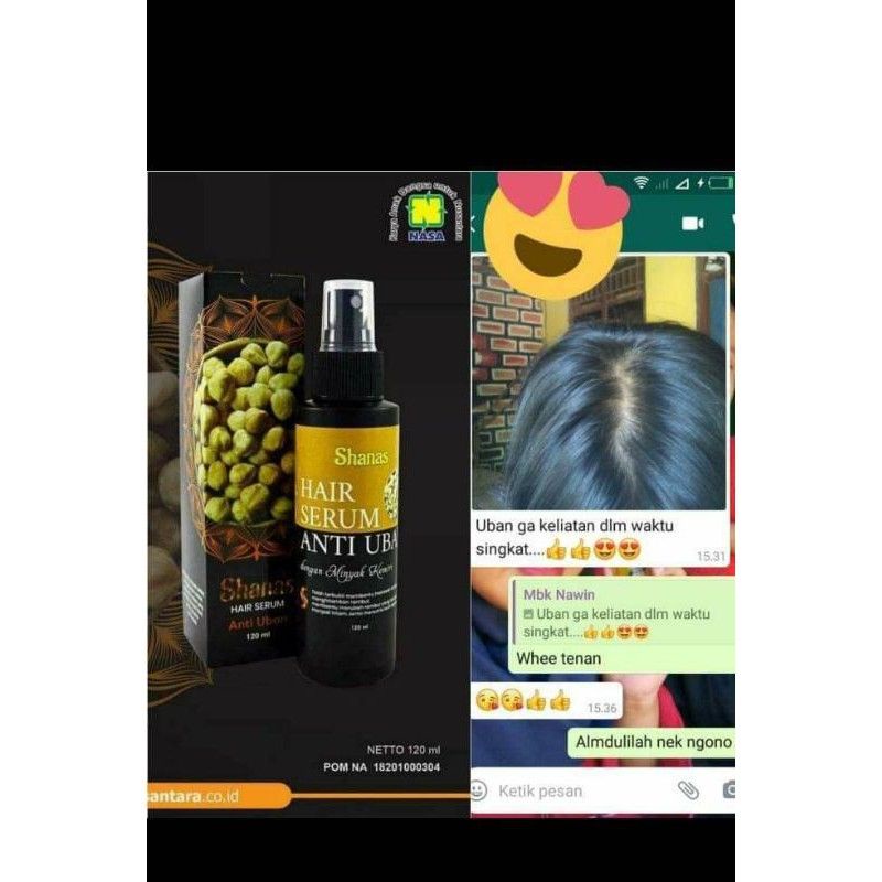 SHANAS HAIR SERUM ANTI UBAN /SERUM MENGHITAMKAN UBAN /SERUM PENGHILANG UBAN /SHANAS ANTI UBAN NASA /