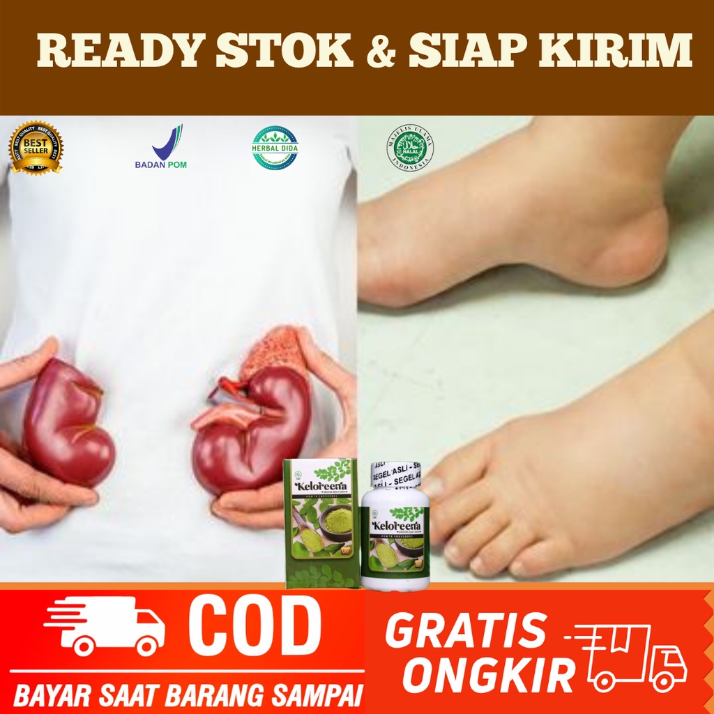 Obat Kaki Bengkak Karena Ginjal, Obat Kaki Bengkak Asam Urat, Obat Bengkak Pada Kaki, Obat Kaki Beng