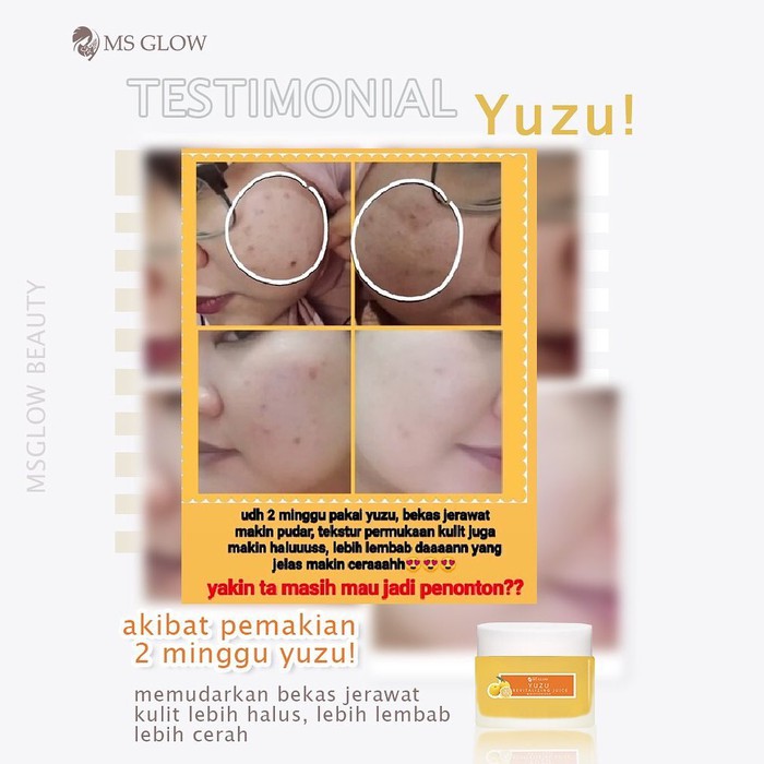 MS GLOW YUZU REVITALIZING JUICE MOISTURIZER