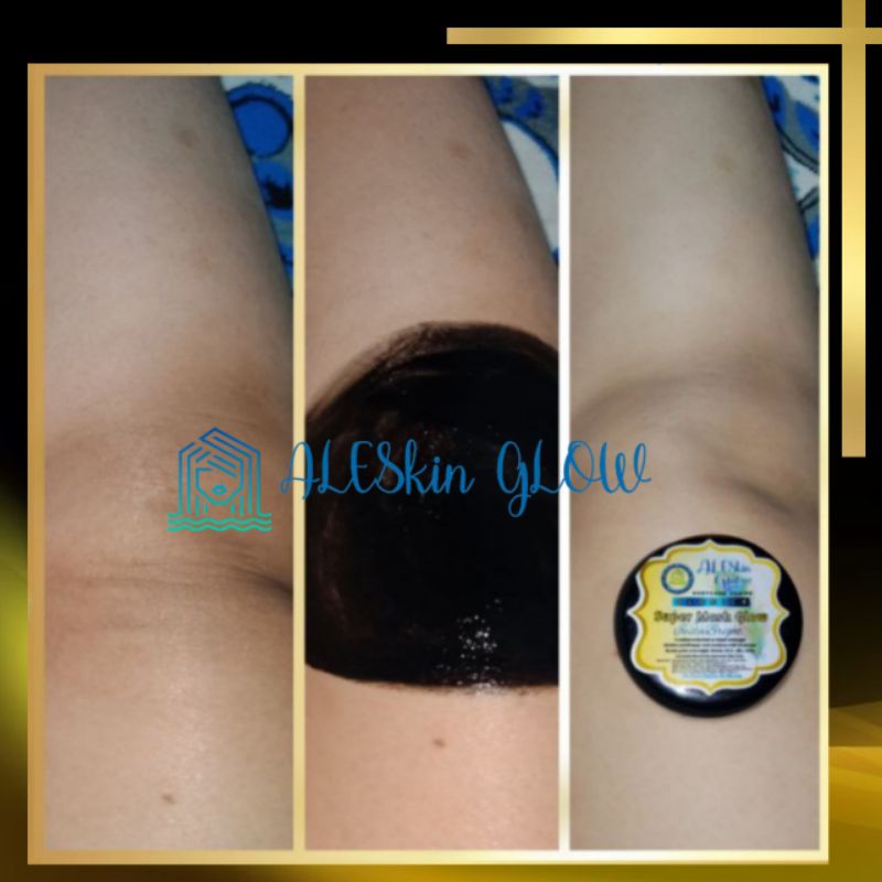 Masker Pemutih Wajah Glowing Super Mask Glow Aleskin