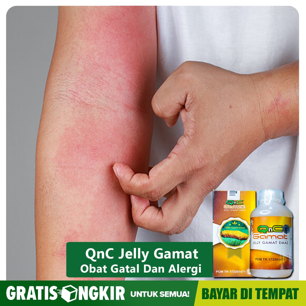 Obat Untuk Atasi Gatal Gatal Di Lengan Di Selangkangan Di Tubuh Qnc Jelly Gamat Herbal Shopee Indonesia