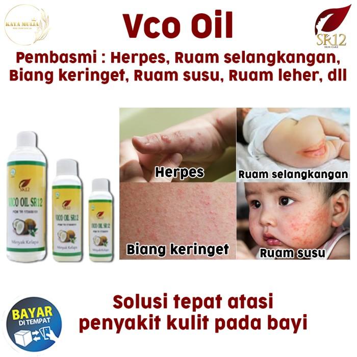 Oil Vico Oil Sr12 Obat Ruam Bayi / Ruam Popok / Ruam Leher / Gatal-Gatal