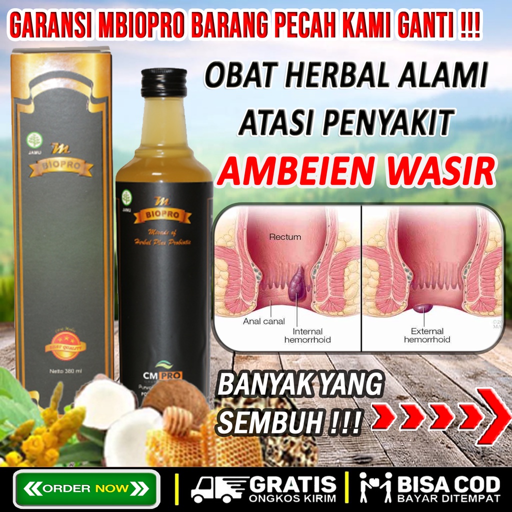 Obat Ambeien Paling Ampuh, Stadium 4, Obat Ambeien Anus Keluar, Obat Ambeien Wasir, Obat BAB Berdara