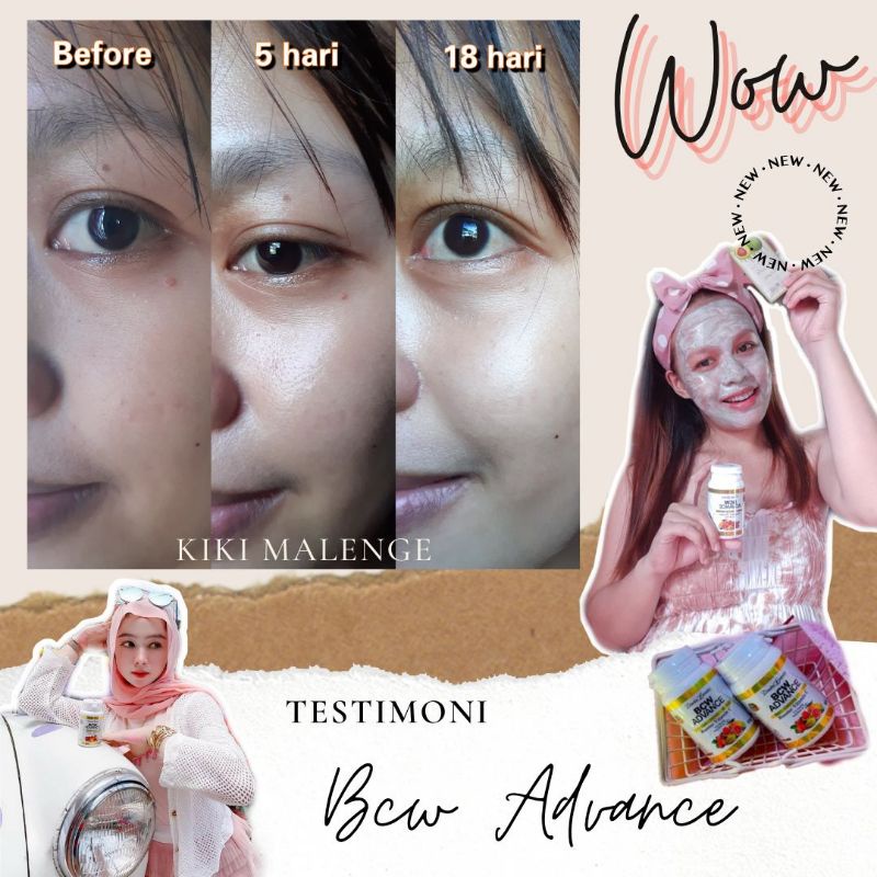 

BCW ADVANCE PEMUTIH SELURUH TUBUH DIJAMIN ORI VIT C