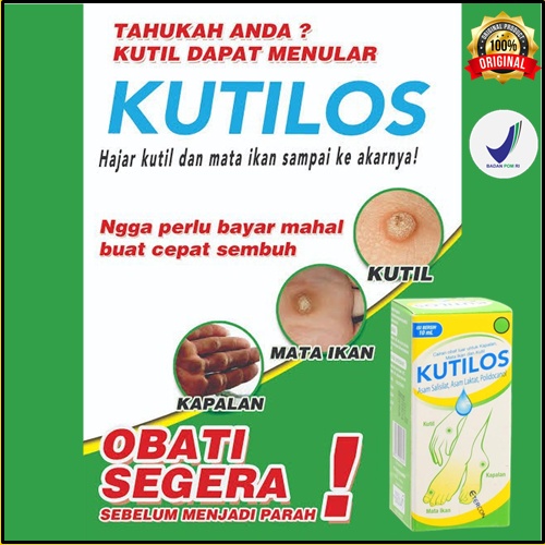 ORIGINAL Kutilos obat kutil 10ml obat mata ikan telapak kakai kutil kapalan ampuh BPOM