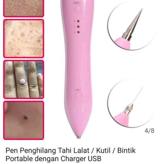 Laser penghilang kutil / tahi lalat
