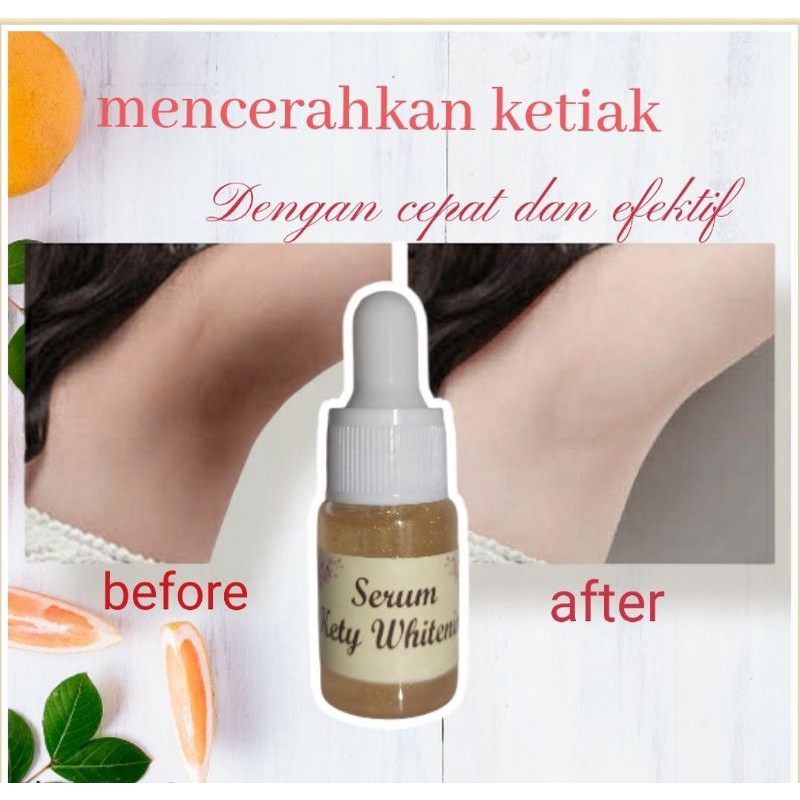 SERUM PEMUTIH KETIAK/ PEMUTIH SELANGKANGAN/ KETY GLOWING/KETY WHITENING