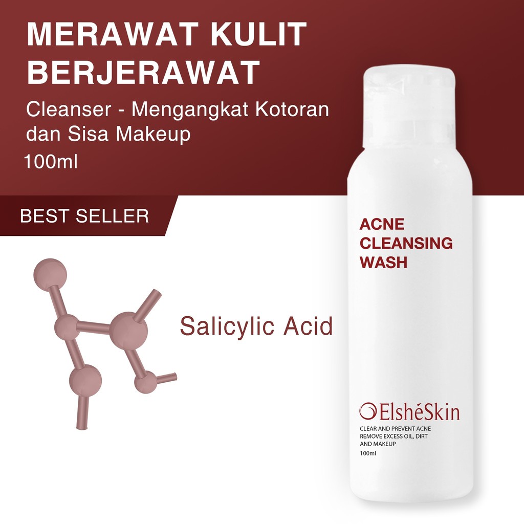 ❤️ Cloudy ❤️ ELSHESKIN Acne Cleansing Wash 100ml  / Facial Wash Elshe Skin Original 100%