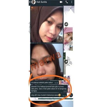 Queena marwa sabun herbal alami