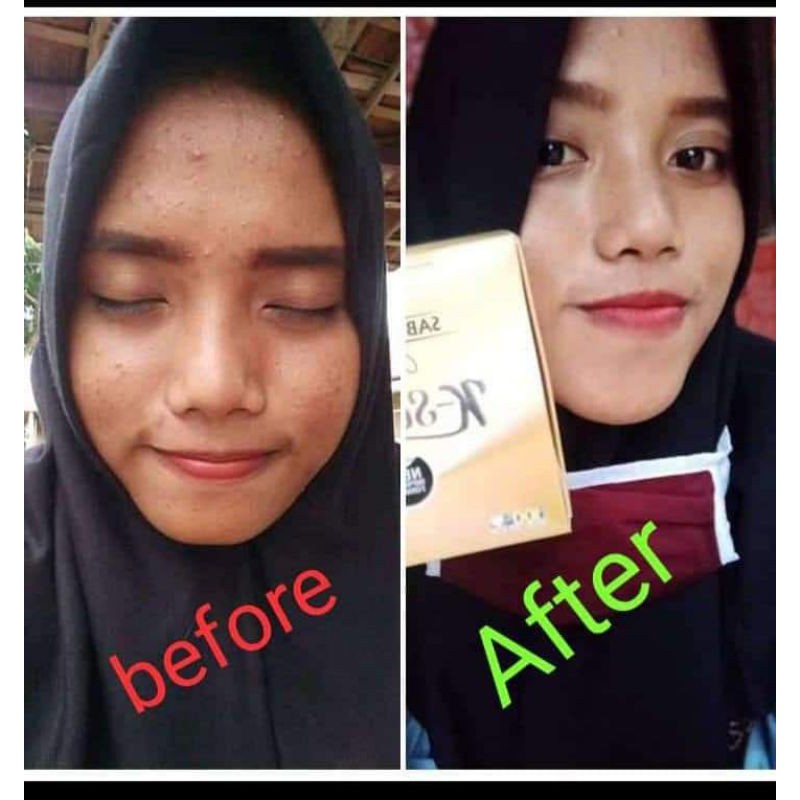 SABUN ZAITUN K-SELARAS 1000% ORIGINAL