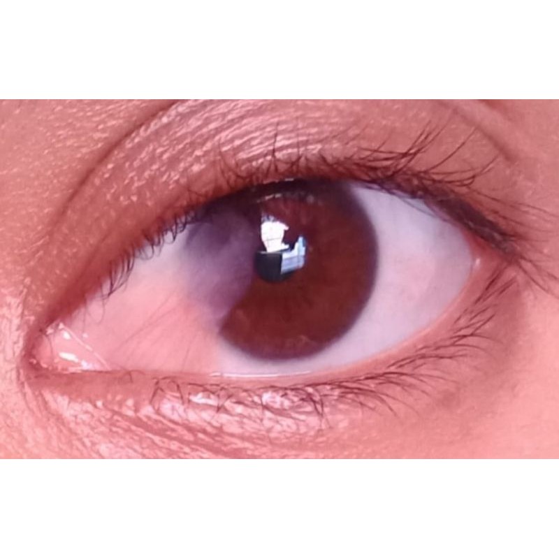 Nama produk OBAT MATA BERLEMAK/ OBAT MATA KATARAK/OBAT MATA MINUS AMPUH DLL