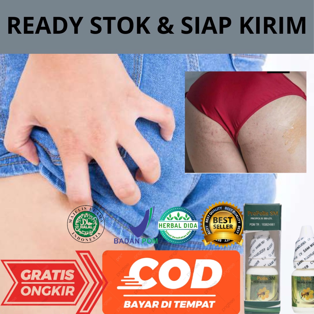 Obat Koreng di pantat, Obat Pantat Bruntusan,  Obat Ruam Merah Di Pantat, Obat Pantat Hitam, Obat Pa