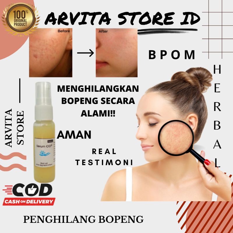 Jual Serum Wajah Penghilang Bekas Jerawat Bopeng Cacar Ampuh Pria