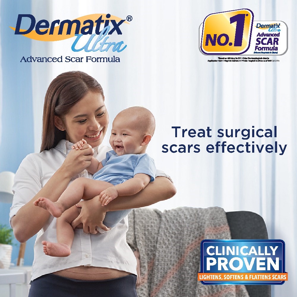 Dermatix Ultra Gel 15gr Advanced Scar Formula Gel LKrim Penghilang Bekas Luka / Bakar / Keloid Anti Scar Stretchmark Dermatik Dermatic