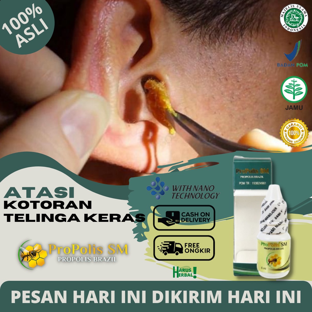 Obat Tetes Pelunak Kotoran Telinga, Obat Kotoran Telinga Kering Dan Keras, Obat Penumpas/Penghancur 