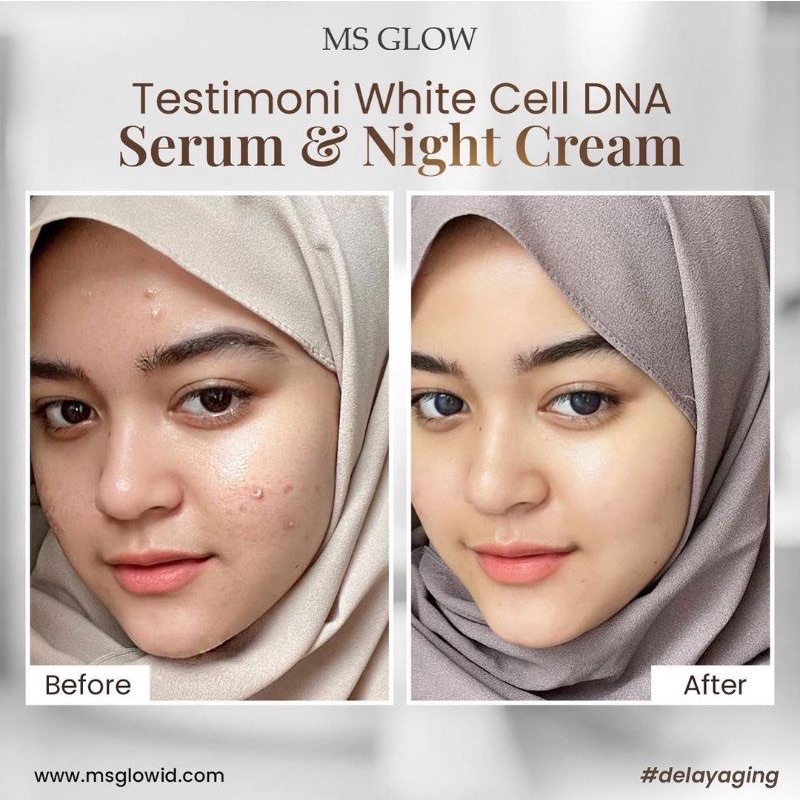 Ms Glow Paket WhiteCellDNA || Paket White Cell DNA MS GLOW