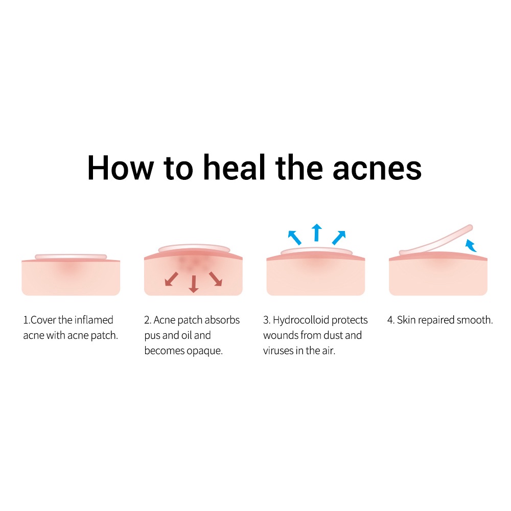 BREYLEE / ALLPHV Acne Pimple Patch Removal Penghilang Jerawat Day Use 0.1mm and Night Use 0.3mm (22 stiker)