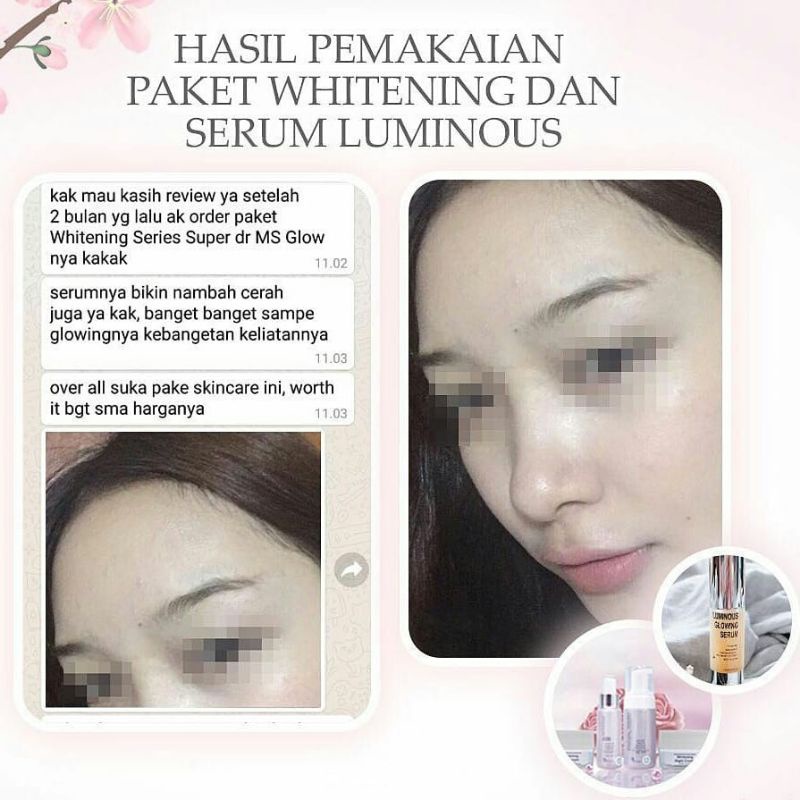 SERUM MS GLOW/SERUM LUMINOS/SERUM WHITENING GOLD/SERUM ACNE