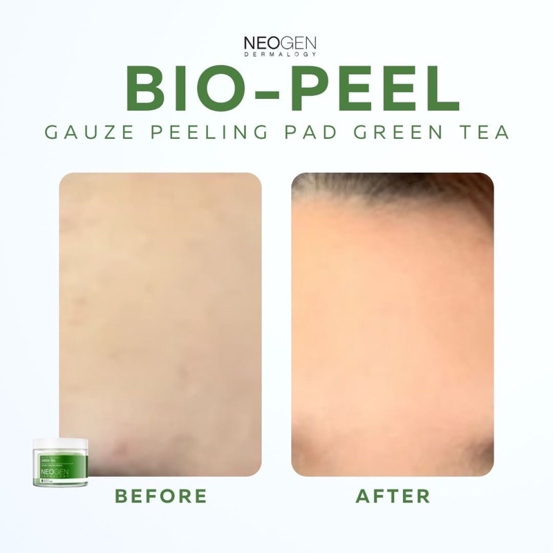 NEOGEN Bio Peel Gauze Peeling Pad Small Jar isi 18 Pcs - LEMON | GREENTEA | WINE Kapas Exfoliator, Exfoliasi
