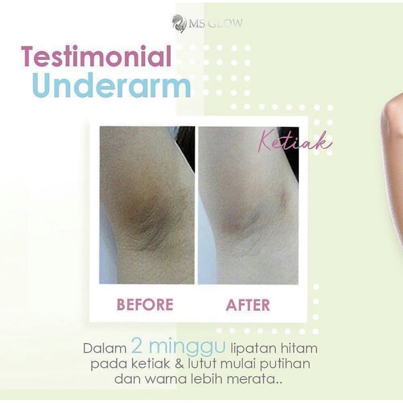 UNDERARM - PEMUTIH KETIAK - MS GLOW