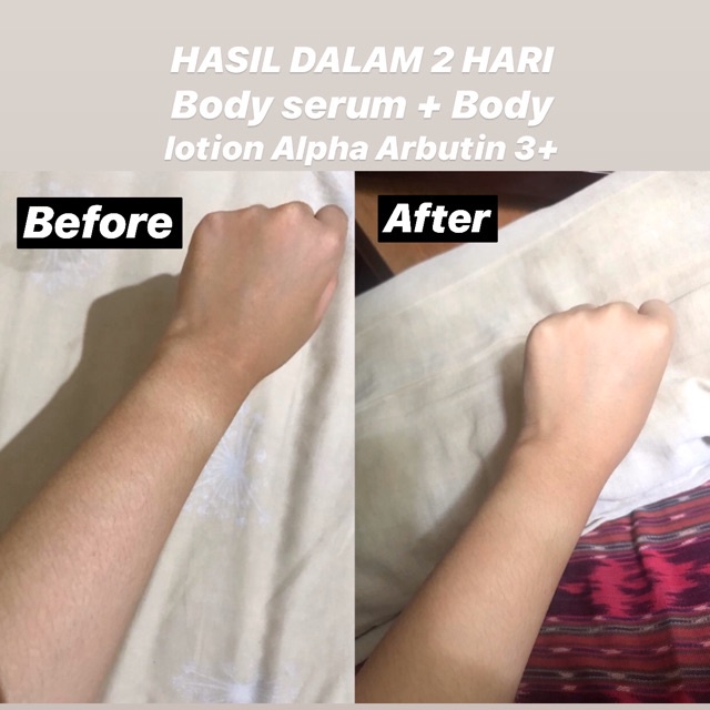 𝐖𝐇𝐈𝐓𝐄𝐍𝐈𝐍𝐆 𝐒𝐎𝐀𝐏 - Precious Skin Alpha Arbutin 3 Plus Colagen Whitening Soap / Sabun Pemutih Badan / Sabun PencerahBadan 80 gr