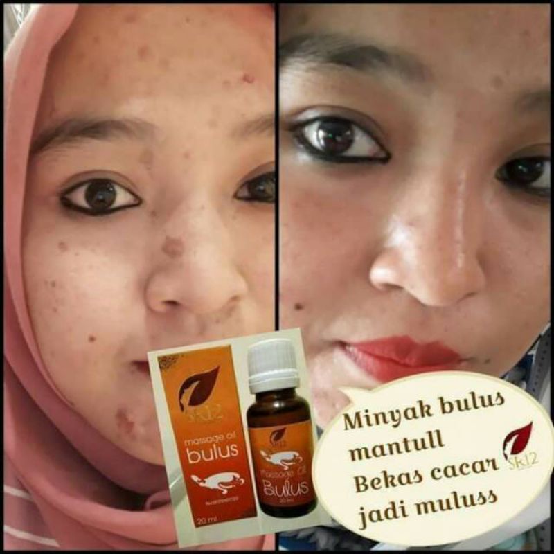 (COD) SABUN SERBAGUNA!! SABUN BULUS/ SABUN UNTUK GATAL-GATAL/ SABUN JERAWAT/ STRETCHMARK/ PENGENCANG / MENGHILANGKAN PECAH PECAH DI KAKI / MENGECILKAN PORI - PORI