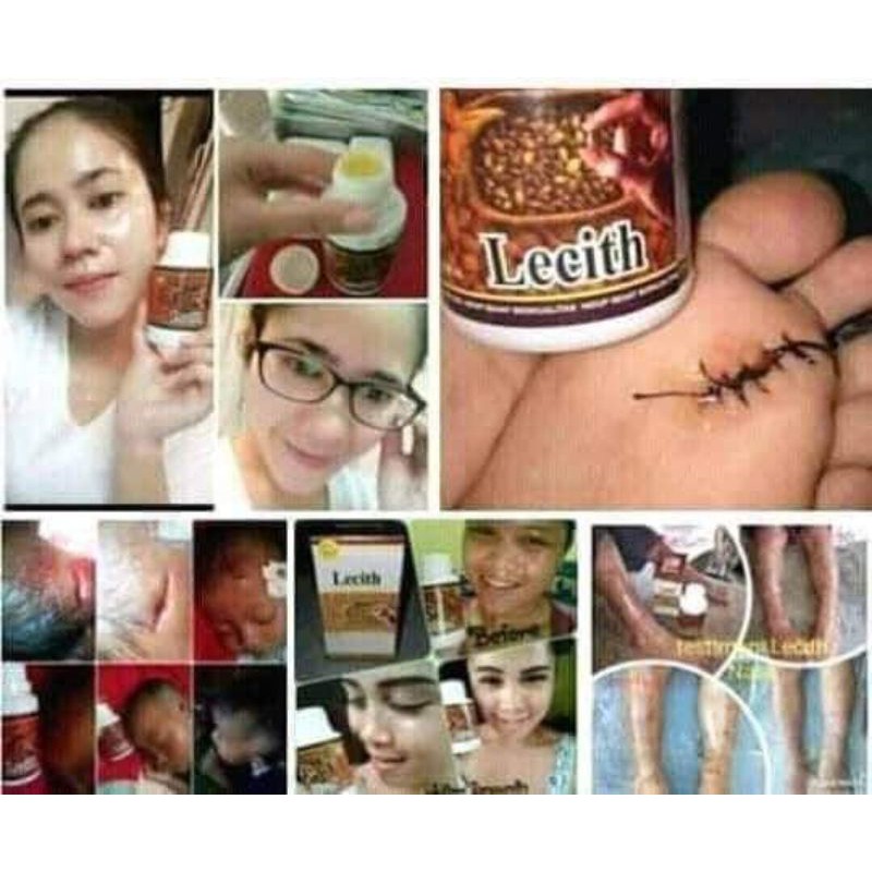 obat sapu jagat kemasan kecil/LECITH_NASA