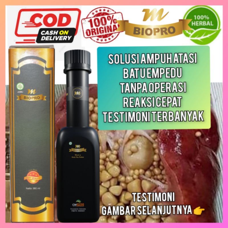 M Biopro Asli Obat Batu Empedu 380 ml Reaksi Cepat Testimoni Terbanyak
