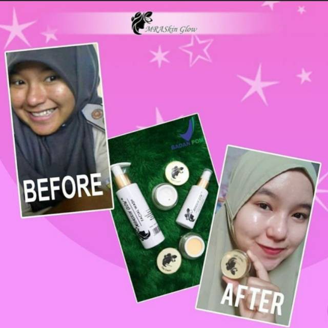 Paket Wajah MRA SKIN GLOW/ Paket Cream Pemutih Wajah/ Mraskin Glow Paket Skincare Wajah Bpom