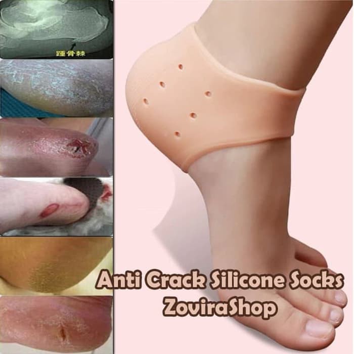 ANTI CRACK SILICONE SOCKS SILICONE ANTI KULIT KAKI PECAH KERING KASAR