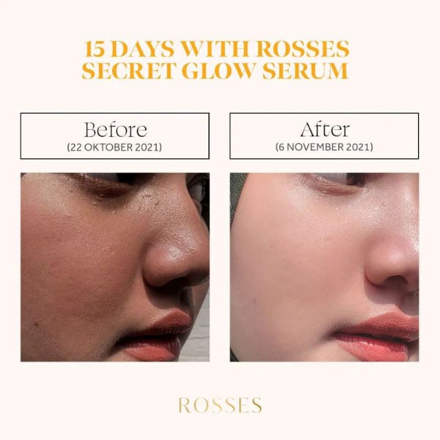 Serum Rosses Glow Serum Mencerahkan Melembabkan, Anti Aging dan Glowing 100% Original BPOM