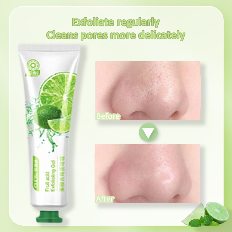 【READY STOCK】OULISI Fruit Acid Exfoliating Gel 30g Facial Glowing Blackhead Cleaner Body Exfoliating