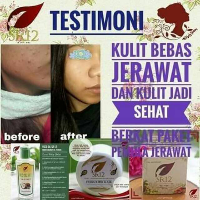 ❤️PAKET PEMULA JERAWAT SR12 Skincare/PAKET PEMULA COFFE/PAKET PEMULA KOPI SR12❤️