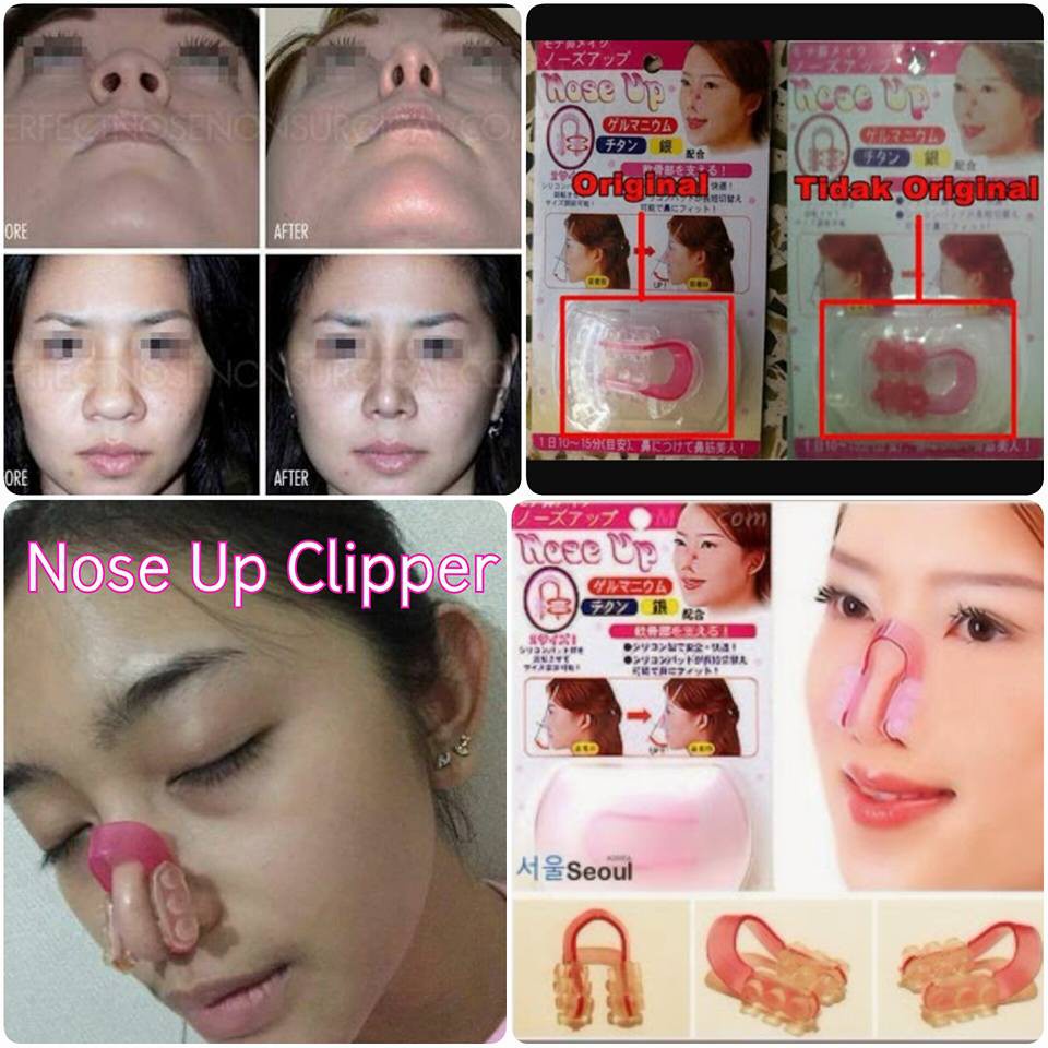 NOSE UP CLIPPER / Alat Pemancung Hidung Alami / Alat Terapi Tulang Rawan Manual