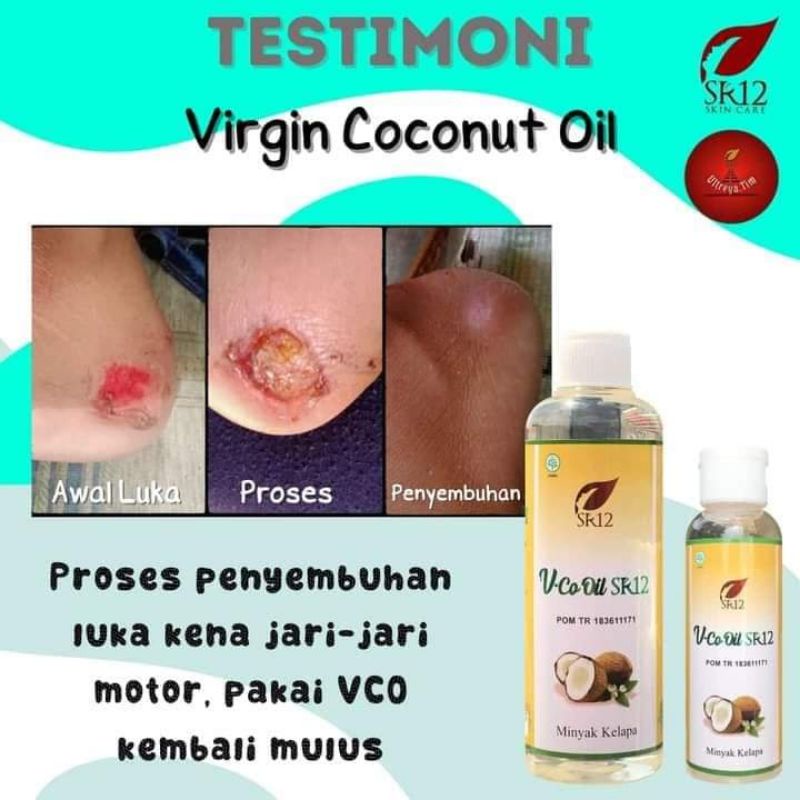 vico oil sr12 herbal skincare aman bpom terlaris 100/ original