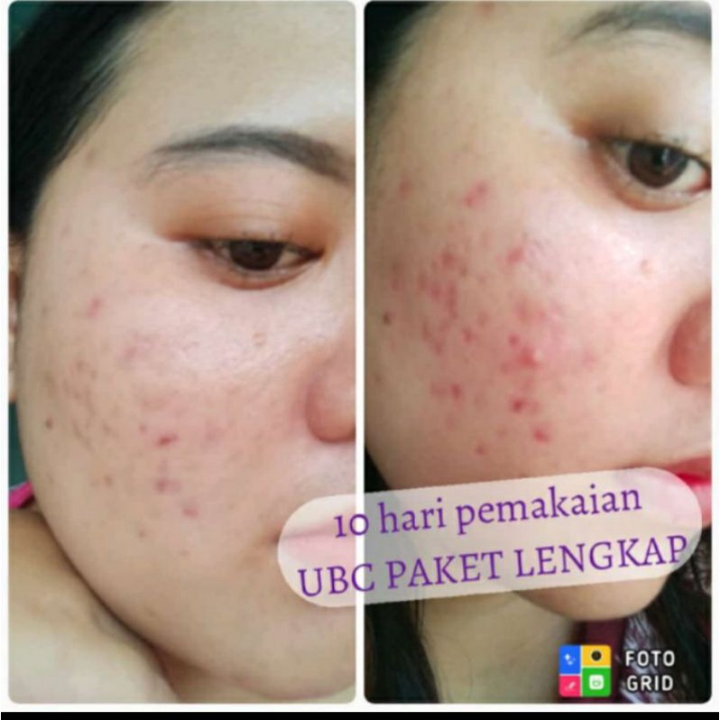 Sepaket skincare BPOM BY UMI ALFATIH/CREAM UBC/SERUM UBC/TONER UBC/SUNSCREEN UBC