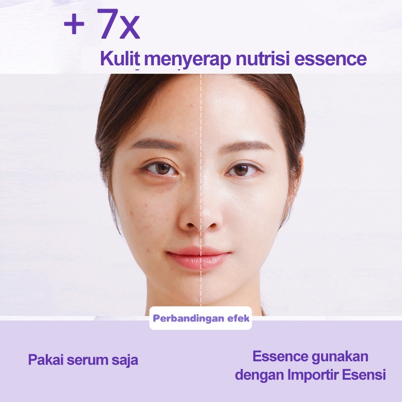 AmazeFan Alat Setrika Esensi Pemutih Alat Impor Serum Anti Penuaan Pemijat Wajah Serum Facial Pelangsing Wajah Lifting Massager Perbaikan Jerawat Mesin Rf