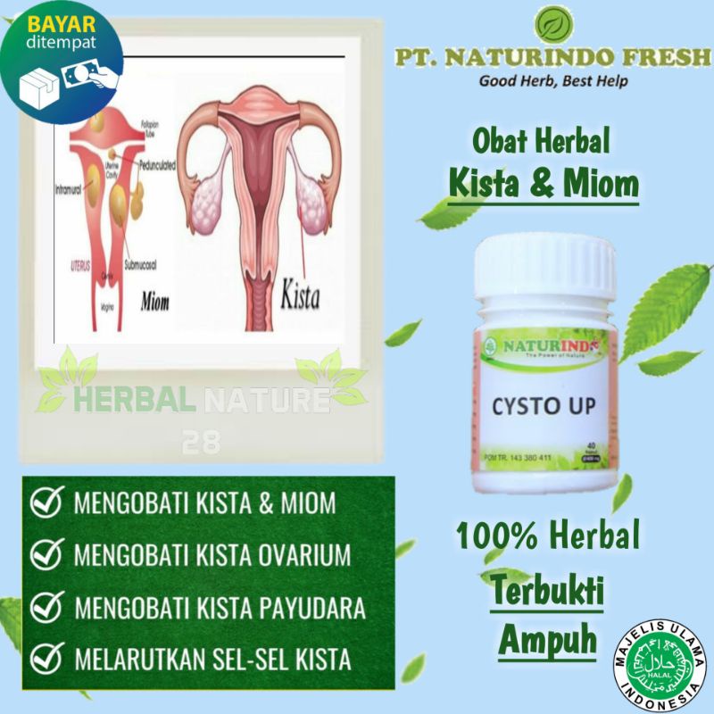 Jual Obat Herbal Kysta Kista Dan Miom Naturindo Fit Shopee Indonesia 6891