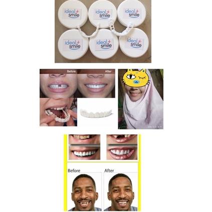 [KODE PRODUK WIDHG9059] IDEAL SMILE GIGI PALSU ATAS BAWAH GIGI PALSU LEPAS PASANG VENEER snap on smi