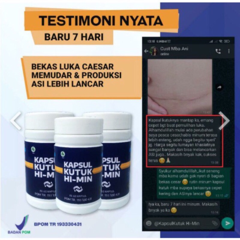 𝗞𝗔𝗣𝗦𝗨𝗟 𝗞𝗨𝗧𝗨𝗞 𝗛𝗜 𝗠𝗜𝗡 Ekstrak Albumin Ikan Gabus Obat Pasca Operasi 5x Bekas Luka Jahitan Cepat Kering
