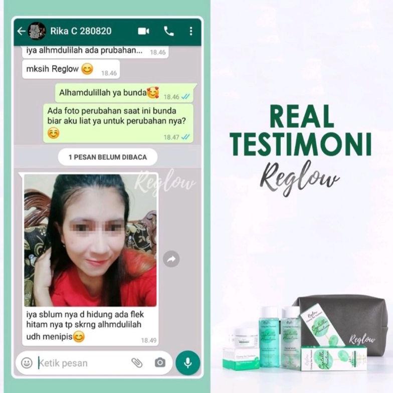 Reglow Skincare Original / Re Glow / Reglow Beauty / Skincare Reglow / Re Glow Skincare / Reglow Bea