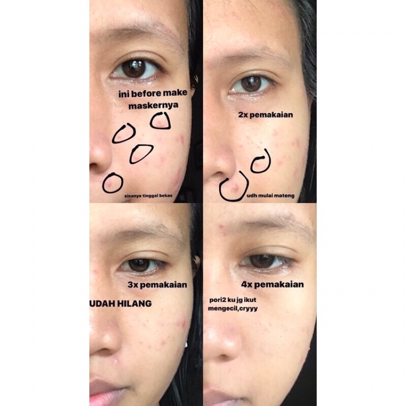 BPOM Camille product 25gr - 65gr (baca deskripsi)-5