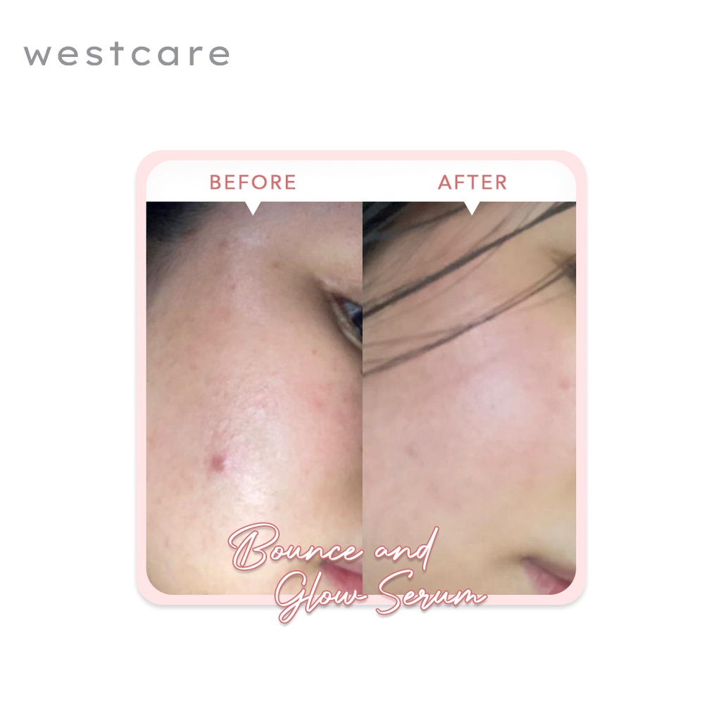 Westcare Bounce and Glow Serum-7