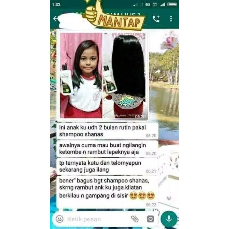 COD FREEONGKIR SHAMPO PENGHILANG OBAT KUTU SHANAS ORI - SHAMPO KUTU RAMBUT , KETOMBE DAN RAMBUT LEPEK WANGI