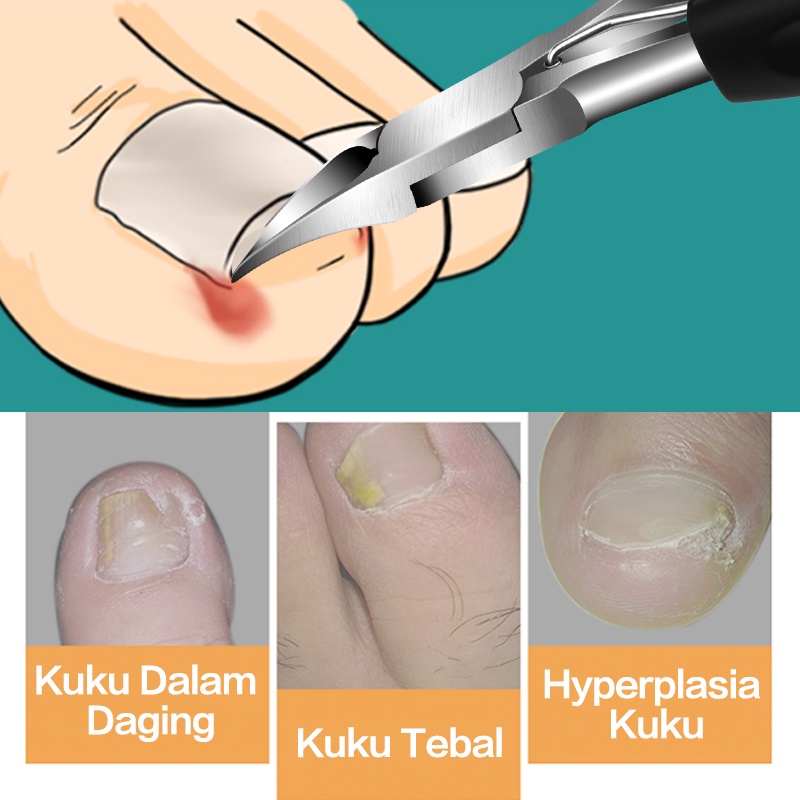 Gunting Kuku Miring Anti Cantengan Pemotong Kuku Miring Jempol Kaki Stainles Steel