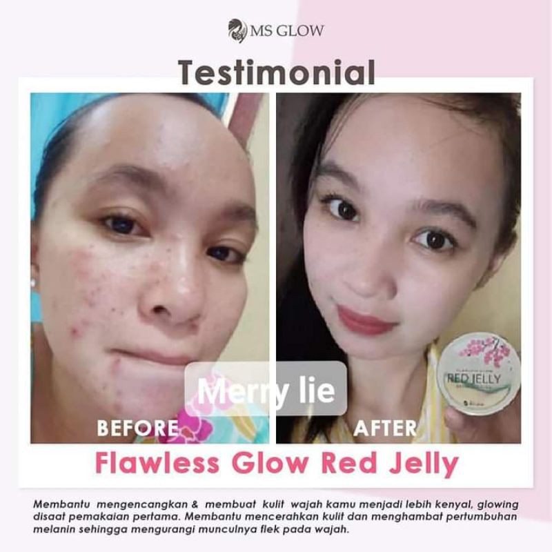 RED JELLY MS GLOW FREE JJ GLOW MINI