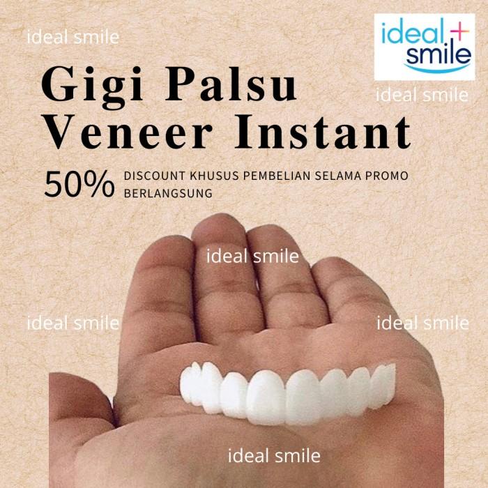 Vier | Ideal Smile Gigi Palsu Atas Bawah Gigi Palsu Instan Lepas Pasang Vener