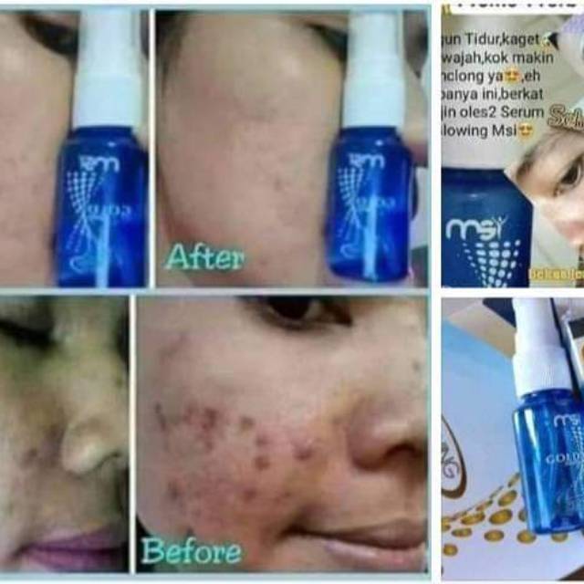 Serum glow MSI (serium msi)